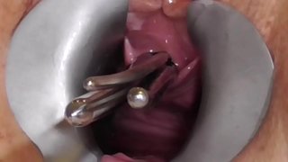 ���ັ FreyjaAnalslut:ໄຂ້ໃນ Freyja ນ pisshole